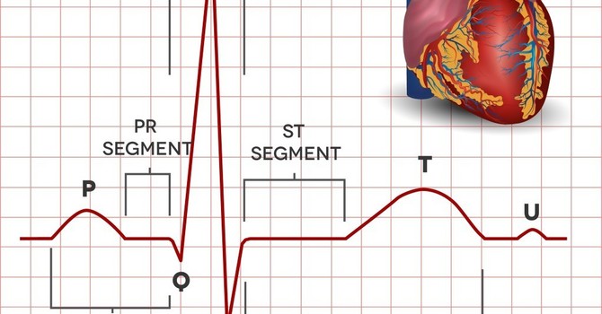 Electrocardiogram EKG