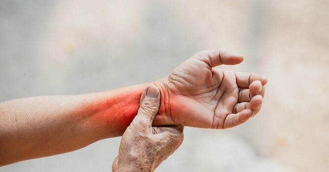 Wrist Pain Relief in St. Paul image