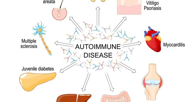 Understanding Autoimmune Conditions