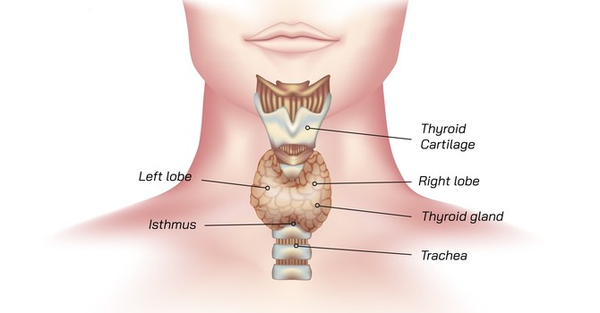 Hashimoto’s Disease